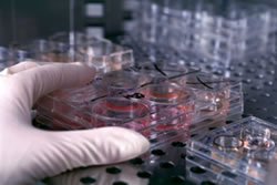 Quali sono le applicazioni terapeutiche delle cellule staminali del sangue e le prospettive della ricerca?