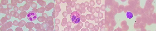 Granulociti neutrofili, eosinofili e basofili al microscopio ottico circondati da globuli rossi