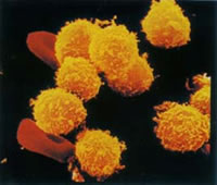 In giallo globuli bianchi al microscopio elettronico a scansione (SEM)