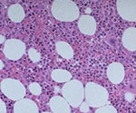 Quali sono le applicazioni terapeutiche delle cellule staminali del sangue e le prospettive della ricerca?