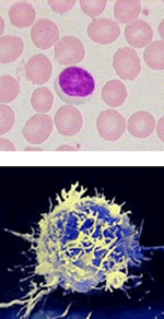 Linfociti al microscopio ottico ed elettronico