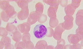 Globuli rossi al microscopio ottico, al centro un globulo bianco
